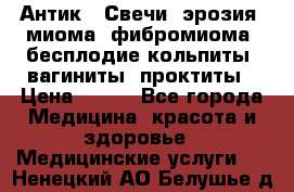 Антик.  Свечи (эрозия, миома, фибромиома, бесплодие,кольпиты, вагиниты, проктиты › Цена ­ 550 - Все города Медицина, красота и здоровье » Медицинские услуги   . Ненецкий АО,Белушье д.